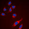 Ribosomal Protein S6 antibody, LS-C358301, Lifespan Biosciences, Immunofluorescence image 