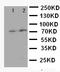 Forkhead Box P1 antibody, LS-C312749, Lifespan Biosciences, Western Blot image 