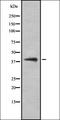 Galectin 8 antibody, orb337142, Biorbyt, Western Blot image 