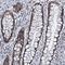 Formin-binding protein 11 antibody, NBP1-87933, Novus Biologicals, Immunohistochemistry frozen image 