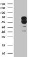 Dihydropyrimidinase Like 2 antibody, TA811601, Origene, Western Blot image 