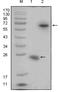R-Spondin 1 antibody, abx011430, Abbexa, Enzyme Linked Immunosorbent Assay image 