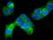 CD63 Molecule antibody, 11271-MM03, Sino Biological, Immunohistochemistry frozen image 