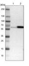 Seryl-tRNA synthetase, mitochondrial antibody, NBP1-80765, Novus Biologicals, Western Blot image 