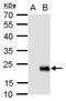 GAIP antibody, GTX129412, GeneTex, Western Blot image 