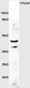 Hydroxyindole O-methyltransferase antibody, GTX01086, GeneTex, Western Blot image 