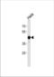 CTF antibody, TA324589, Origene, Western Blot image 