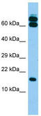 B9 Domain Containing 2 antibody, TA331714, Origene, Western Blot image 