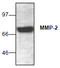 Matrix Metallopeptidase 2 antibody, AP26359PU-N, Origene, Western Blot image 