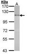 Hepatocyte Growth Factor-Regulated Tyrosine Kinase Substrate antibody, PA5-27502, Invitrogen Antibodies, Western Blot image 