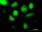 Azurocidin 1 antibody, H00000566-B01P, Novus Biologicals, Immunocytochemistry image 