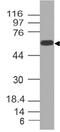 5'-Nucleotidase Ecto antibody, M02120, Boster Biological Technology, Western Blot image 