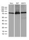 ATP Binding Cassette Subfamily F Member 2 antibody, LS-C792658, Lifespan Biosciences, Western Blot image 
