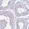 Chromosome 6 Open Reading Frame 163 antibody, PA5-60830, Invitrogen Antibodies, Immunohistochemistry paraffin image 