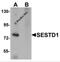 SEC14 And Spectrin Domain Containing 1 antibody, 5877, ProSci, Western Blot image 