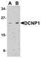 Dendritic Cell Associated Nuclear Protein antibody, PA5-72808, Invitrogen Antibodies, Western Blot image 