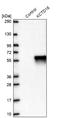 Potassium Channel Tetramerization Domain Containing 16 antibody, NBP2-30652, Novus Biologicals, Western Blot image 