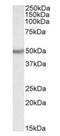 UDP-glucuronosyltransferase 2B2 antibody, orb22538, Biorbyt, Western Blot image 
