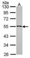 Ribosomal RNA Processing 1 antibody, PA5-30278, Invitrogen Antibodies, Western Blot image 