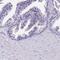 Proline-rich protein 15 antibody, NBP2-30799, Novus Biologicals, Immunohistochemistry paraffin image 