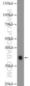 Abhydrolase Domain Containing 6 antibody, 20494-1-AP, Proteintech Group, Western Blot image 