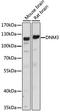 Dyn3 antibody, A06890, Boster Biological Technology, Western Blot image 