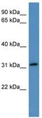 Secreted frizzled-related protein 3 antibody, TA335006, Origene, Western Blot image 