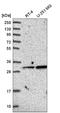 GLYAT antibody, NBP2-55298, Novus Biologicals, Western Blot image 