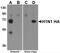 Influenza A H1N1 Hemagglutinin antibody, 5237, ProSci, Enzyme Linked Immunosorbent Assay image 