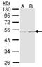 Cytochrome C Oxidase Assembly Homolog COX15 antibody, GTX102999, GeneTex, Western Blot image 
