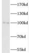SATB Homeobox 1 antibody, FNab07615, FineTest, Western Blot image 