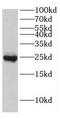 Eukaryotic Translation Initiation Factor 4E Family Member 3 antibody, FNab02722, FineTest, Western Blot image 