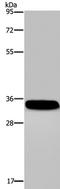 Carbonic Anhydrase 4 antibody, TA323574, Origene, Western Blot image 