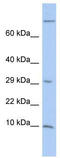 Matrix Gla protein antibody, TA339184, Origene, Western Blot image 