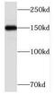 Transcription Elongation Regulator 1 antibody, FNab08551, FineTest, Western Blot image 