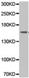 Phospholipase C Gamma 2 antibody, TA322975, Origene, Western Blot image 