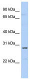 Small Nuclear Ribonucleoprotein Polypeptide A' antibody, TA345825, Origene, Western Blot image 