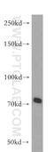 ATP Binding Cassette Subfamily B Member 9 antibody, 11066-1-AP, Proteintech Group, Western Blot image 