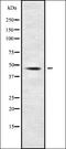 Chloride Voltage-Gated Channel 1 antibody, orb338173, Biorbyt, Western Blot image 