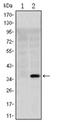 Organic cation transporter 1 antibody, AM06553SU-N, Origene, Western Blot image 