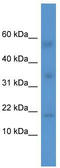 Interleukin 1 Family Member 10 antibody, TA342892, Origene, Western Blot image 