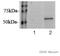Glucosylceramidase Beta antibody, ab55080, Abcam, Western Blot image 