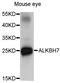 Probable alpha-ketoglutarate-dependent dioxygenase ABH7 antibody, LS-C335223, Lifespan Biosciences, Western Blot image 