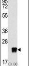 ADP Ribosylation Factor Like GTPase 3 antibody, PA5-12114, Invitrogen Antibodies, Western Blot image 