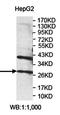 Phosphomannomutase 2 antibody, orb78350, Biorbyt, Western Blot image 