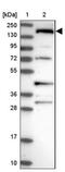 SH3 Domain And Tetratricopeptide Repeats 1 antibody, NBP1-93978, Novus Biologicals, Western Blot image 