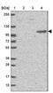 DLG Associated Protein 4 antibody, NBP2-33271, Novus Biologicals, Western Blot image 