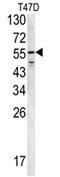 Fibrinogen Beta Chain antibody, AP17374PU-N, Origene, Western Blot image 