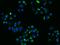 Low Density Lipoprotein Receptor antibody, 50305-R004, Sino Biological, Immunohistochemistry paraffin image 