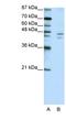 Zinc Finger Protein 419 antibody, NBP1-80366, Novus Biologicals, Western Blot image 